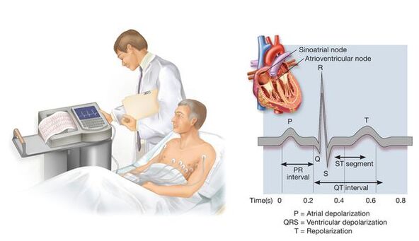 Electrocardiography to detect cardiovascular disease in hypertension